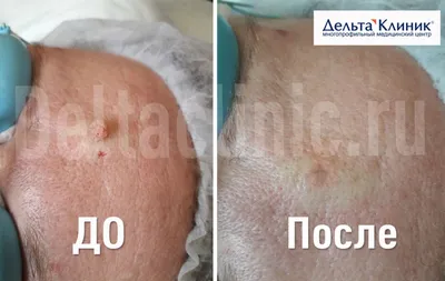Клиника доктора Панова в Новосибирске — отзыв и оценка — Svetl@na