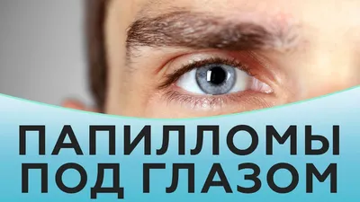 Папилломы на лице - причины, симптомы, диагностика, лечение и профилактика