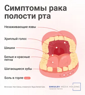 Наросты на языке в полости рта