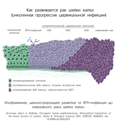 Что такое остроконечные кондиломы у женщин и мужчин - как лечить? |  Лазерсвiт в Одессе