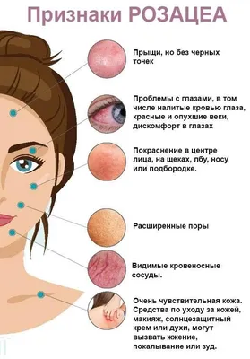 ᐉ Розацеа: что это? Причины, симптомы и методы лечения розацеа