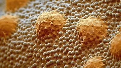 клеточные клетки на раке кожи апельсина, картинка папулы фон картинки и  Фото для бесплатной загрузки