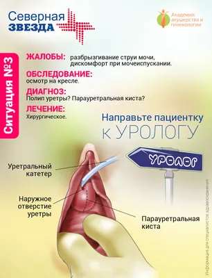 Удаление кисты влагалища в Москве, цена операции в клинике АльтраВита