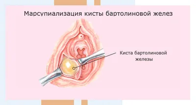 Иллюстрация 11 из 16 для Ошибки и осложнения в урогинекологии - Пушкарь,  Касян | Лабиринт - книги. Источник: