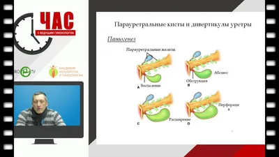 Лазерная урология | Лазерная хирургия в урологии - Эс Класс Клиник Воронеж