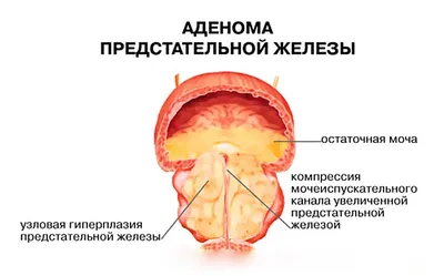 Урологические операции для мужчин — МЦ \"Нордин\"