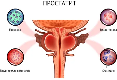 Гибридная реконструкция тазового дна платная операция в Воронеже без очереди