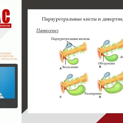 Мочевыделительная система - Kenhub