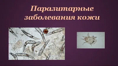 Как паразиты влияют на состояние кожи: признаки заражения организма  паразитами и методы лечения паразитарных заболеваний | Косметология и  эстетическая медицина | Дзен