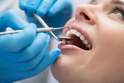 Риски и преимущества зондирования вокруг зубов и дентальных имплантатов  (2425) - Стоматология - Новости и статьи по стоматологии - Профессиональный  стоматологический портал (сайт) «Клуб стоматологов»