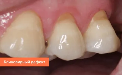 Строение и заболевания зубов