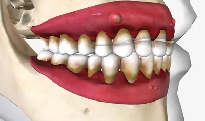 https://www.prezi-dent.ru/uslugi/lechenie-zubov