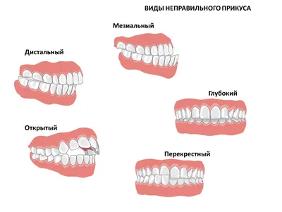 Болезни Зубов 9 Фото Лечение Киев ЛюмиДент