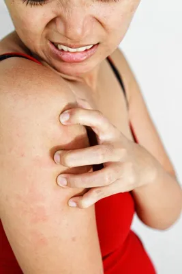 Заболевания кожи: почему возникают, какие симптомы имеют, как лечить