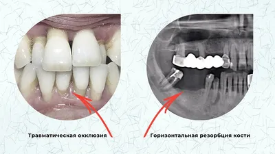 Пародонтология, что это такое? - Статьи