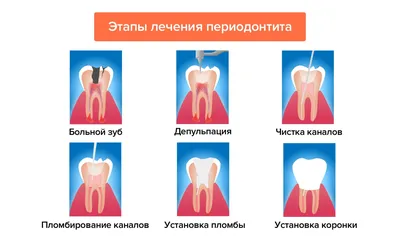 Лечение пародонтита цены Vector Москва метро Полянка стоматология
