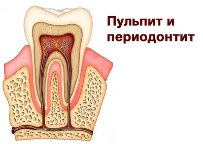 Имплантация зубов как альтернатива лечения периодонтита. Стоматология в  Подольске Улыбка | Стоматология Улыбка