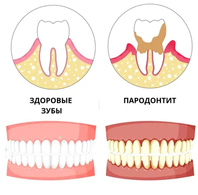 Лечение пульпита и периодонтита в Красноярске - Март - клиника стоматологии