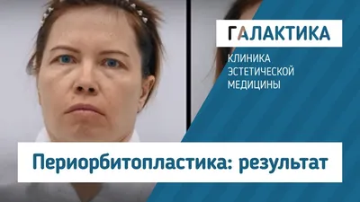 Пластический хирург Марина Четверикова