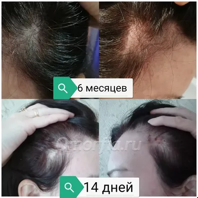 До и после пластической операции — Институт красоты Галактика