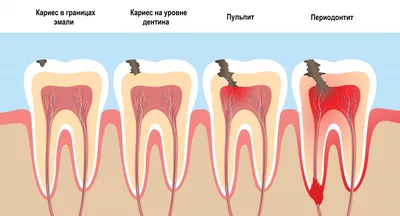 Лечение флюса в клинике ROOTT в Москве - стоимость лечения