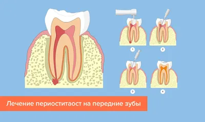 Стоматит у детей: виды, симптомы и лечение