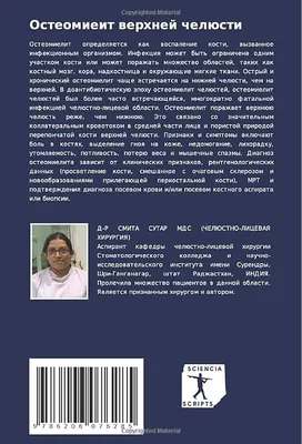 Воспаление десен - что это, основные причины и чем лечить