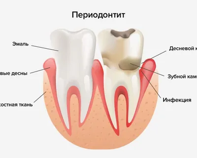 Заболевания полости рта