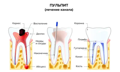 Что делать при воспалении челюсти и как лечить • Диагностический центр  Вальдорф