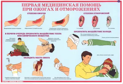 Основы первой помощи, которые нужно знать детям» (для населения) -  Государственное учреждение здравоохранения \"Детская областная больница\"