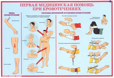 Первая помощь при детских травмах | Klinika.uz - каталог частных клиник и  медицинских центров