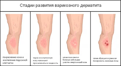 Красные пятна на теле | причины появления пятен на коже, лечение,  диагностика и профилактика