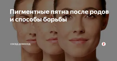 Послеродовая пигментация