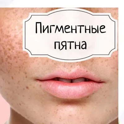 Пигментация после родов, пятна от прыщей и просто пигментные пятна 😨  Девочки, сколько вопросов по поводу борьбы с этой проблемой.… | Sleep eye  mask, Person, Beauty
