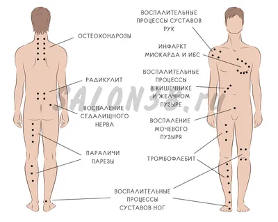 Клиника гирудотерапии – лечение пиявками в Казани
