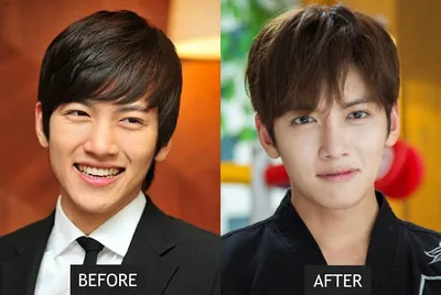 Ты не поверишь этим фото: 10 корейских звезд до и после пластики | theGirl
