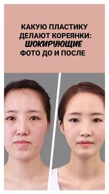 Какие пластические операции делают азиатки: шокирующие фото до и после |  Форма лица стрижка, Ринопластика, Шикарная стрижка