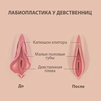 Интимная пластика влагалища после беременности и родов: расширенная  кольпоперинеопластика - YouTube в 2023 г | После беременности,  Беременность, Роды