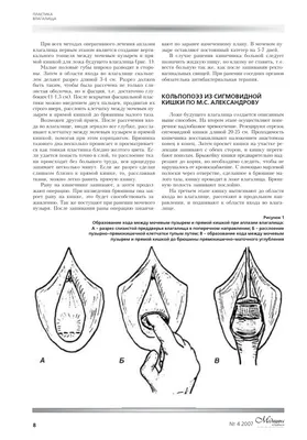 Интимная контурная пластика – подъем вашей сексуальной жизни на новый  уровень! | Многопрофильный медицинский центр в Тюмени — «Авиценна»