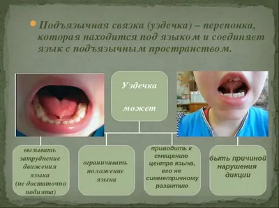 Профессиональная чистка зубов в Днепре [Цена на услугу]- Дентал Евро