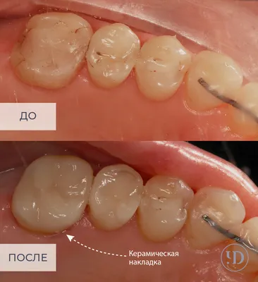 Съемное протезирование - Dental Practice