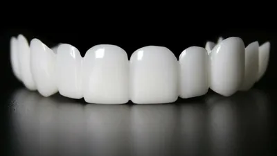 Коронка на зуб - описание, плюсы и минусы, все о зубных коронках | СВОИ ЛЮДИ