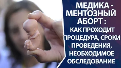 Они отказались от абортов. 7 и 8 июня в Минске прошла акция организации  «Спасение младенцев». Фотофакт | DOKTORA.BY