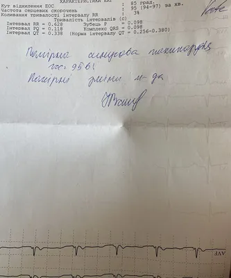 ЭКГ при наиболее частых режимах работы кардиостимулятора: AAI, VVI, VVIR,  DDD