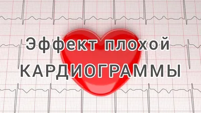 Расшифровка ЭКГ | Пикабу