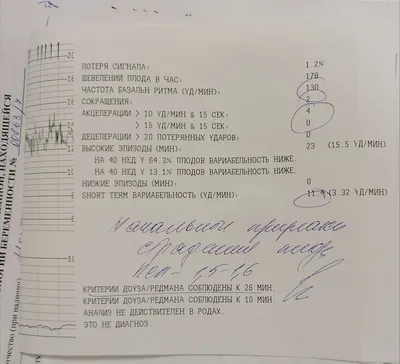 Электрические альтернанты: типы, причины, диагностика и лечение |  КлинКейсКвест