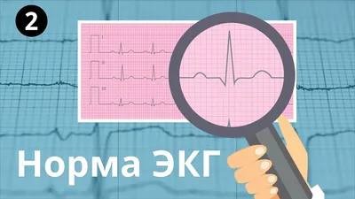 показатели ктг плода норма — 25 рекомендаций на Babyblog.ru
