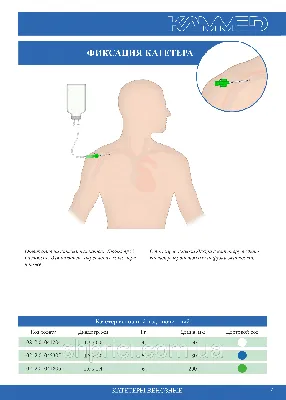 Катетер подключичный венозный КВ-3 (1,4)/ Каммед (ID#118352744), цена:  63.84 ₴, купить на Prom.ua
