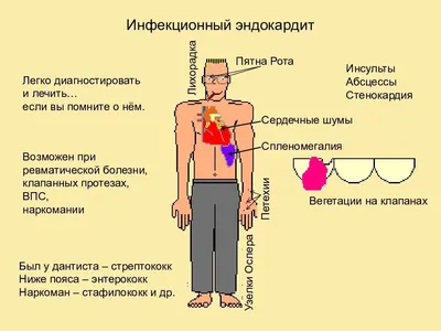 Болезни сердца - кожные симптомы и необходимая диагностика