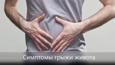 Послеоперационная вентральная грыжа: почему образуется грыжа после операции  - YouTube